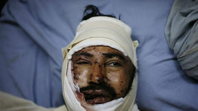 Seorang warga Pakistan terluka akibat bom bunuh diri di Peshawar