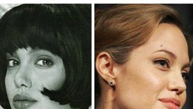 Angelina Jolie - Operasi Hidung