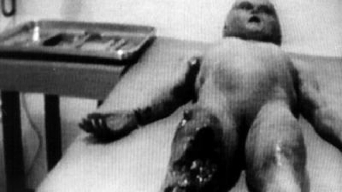 Mayat alien yang ditemui di insiden UFO tahun 1947 tengah diotopsi