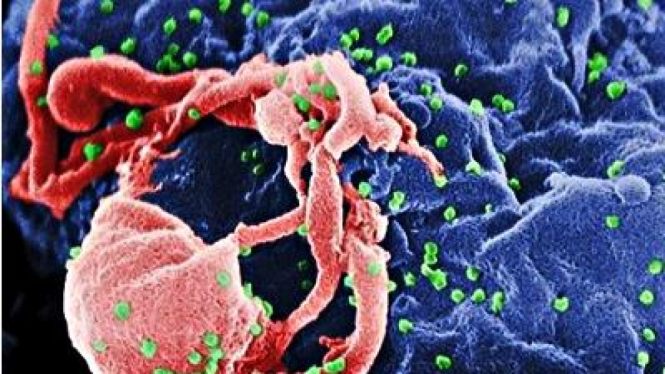 Virus HIV.