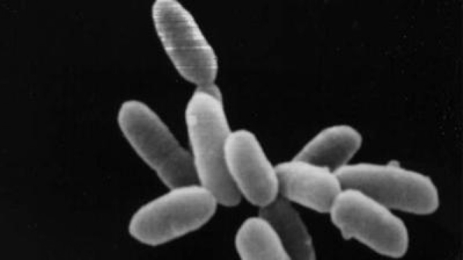 Bakteria yang ditemukan oleh NASA di danau California