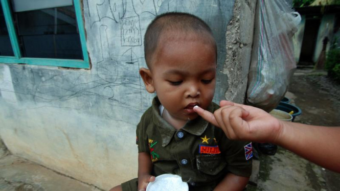 Anak Usia 2 Tahun Gemar Makan Abu Rokok Dan Bedak