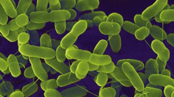 Adalah fungsi besar usus eschericia merupakan yang …. berikut coli di bakteri ini Kumpulan 60+