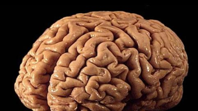 Otak manusia