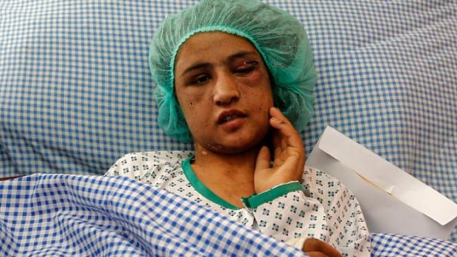 Sahar Gul, wanita yang disiksa di Afganistan