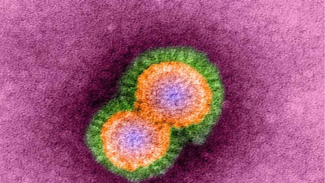Virus Flu Burung