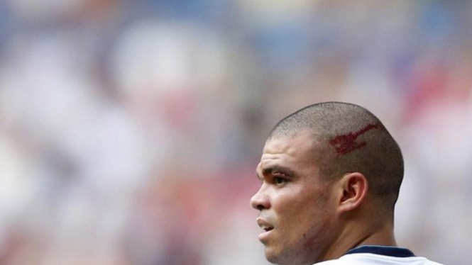 Pemain Real Madrid, Pepe, mengalami cedera kepala