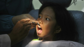 Mom, Lakukan Ini Kalau Gigi Anak Copot Karena Jatuh