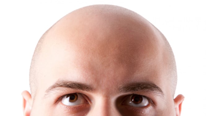 Ilustrasi kepala botak.