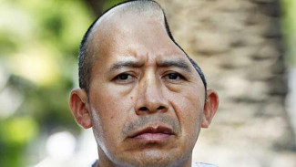 Melerai Perkelahian, Kepala Pria Ini Penyok Kena Pukul