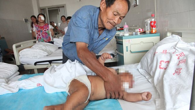 Bayi Xiao Bao ditusuk gunting 90 kali