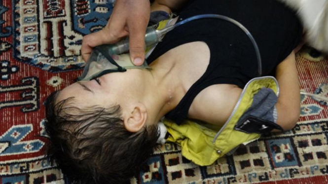 Bocah korban serangan senjata kimia rezim Bashar al-Assad di Ghouta, Suriah