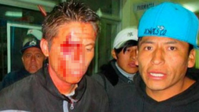 Pemain asal Peru, Martin Dall’Orso, dihajar suporter Unión Fuerza Minera