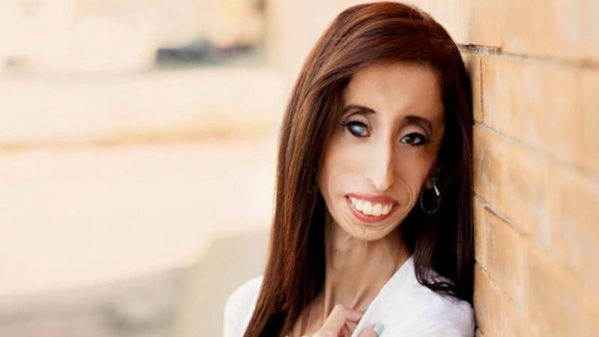 Lizzie Velasquez, Wanita Terjelek di Dunia