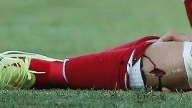 Cedera kaki Diego Costa