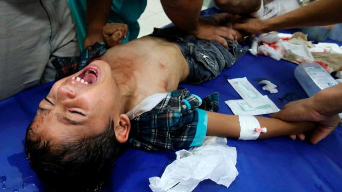 Seorang anak dirawat di Rumah Sakit di Gaza setelah dibombardir Israel
