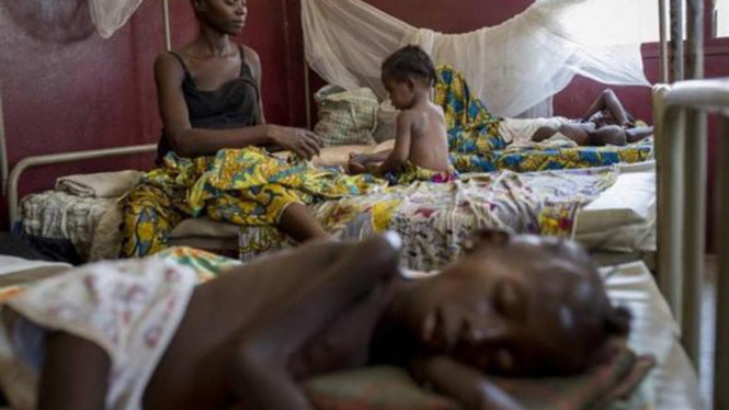 Anak malnutrisi di Afrika Tengah