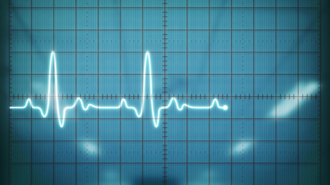Ilustrasi alat atau monitor detak jantung
