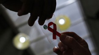 Peneliti Temukan Cara Cegah Penyebaran Sel HIV