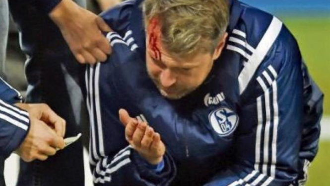 sisten pelatih Schalke, Sven Schubher, usai terhantam roket