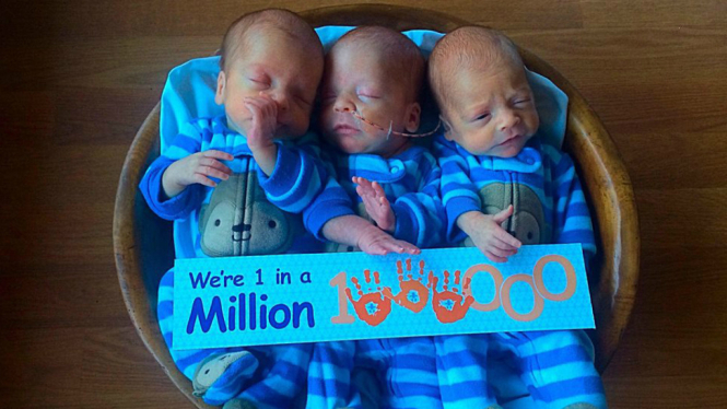 Tiga Anak Kembar Identik Lahir di Billings Clinic