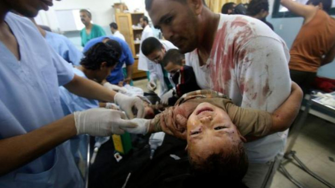 Seorang anak terluka akibat serangan Israel ke sekolah di Gaza, pada 2014.
