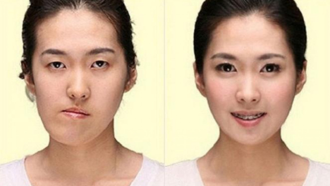 Wajah asli orang korea tanpa operasi plastik