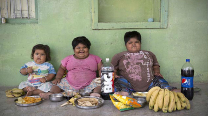 anak obesitas