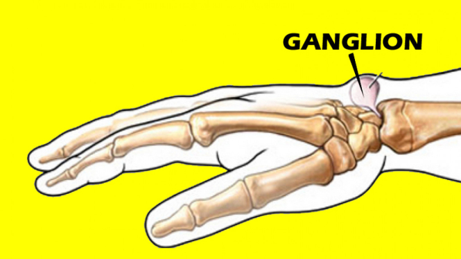 Ganglion