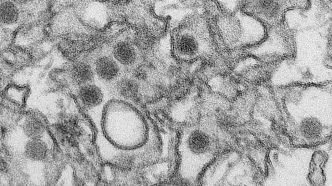 Virus Zika dalam foto yang dirilis CDC AS.