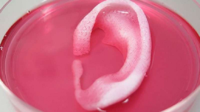 Telinga buatan yang dicetak oleh printer 3D