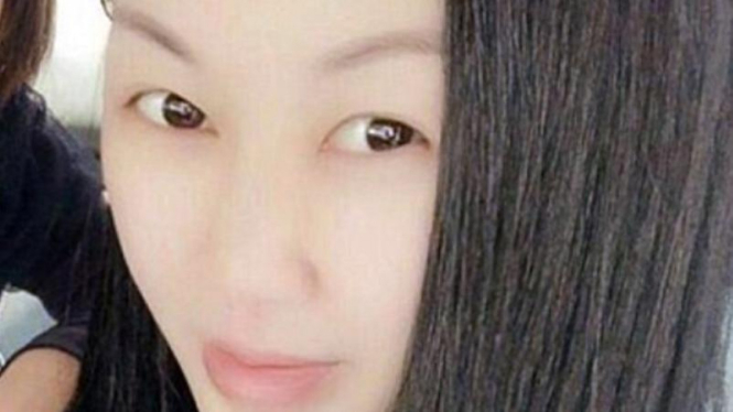 Model Tiongkok tewas saat operasi perbesar payudara