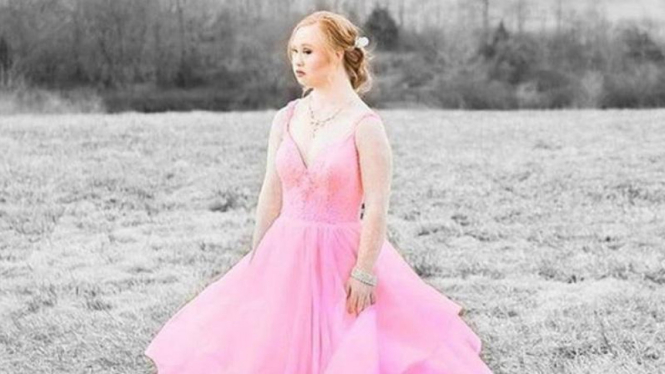 Madeline Stuart, model down syndrome memeragakan koleksi gaun pengantin. 