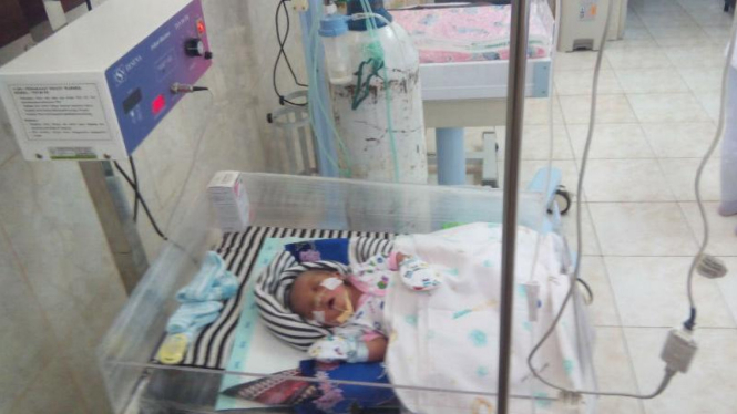 Muhammad Ali Syahbana, bayi yang lahir tanpa anus, dirawat di inkubator pada Rumah Sakit Salewangang, Maros, Sulawesi Selatan, pada Selasa, 14 Maret.