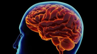 Waspada! Gejala Tumor Otak Kerap Muncul Diam-Diam
