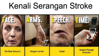 Empat Cara Mudah Kenali Serangan Stroke