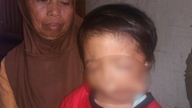Ridho (4 tahun), anak keluarga miskin di Kabupaten Garut, menderita penyakit aneh menyerupai tumor pada bagian rahangnya.