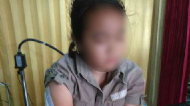 Siswi SD korban teror dengan pola disayat pada lengan di Yogyakarta.