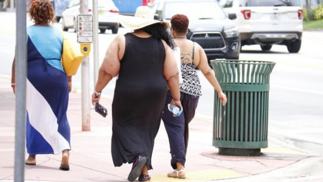 Wanita obesitas.
