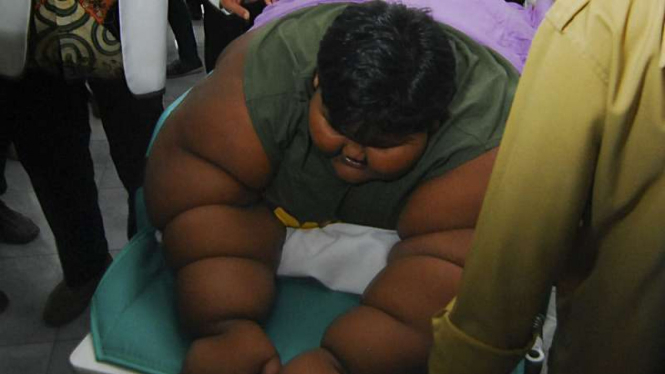 Arya Permana (10), anak dengan bobot tubuh 190 kilogram.