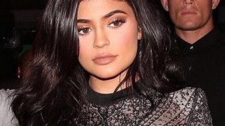 Bibir Kylie Jenner Banyak Ditiru Pasien Filler di Indonesia