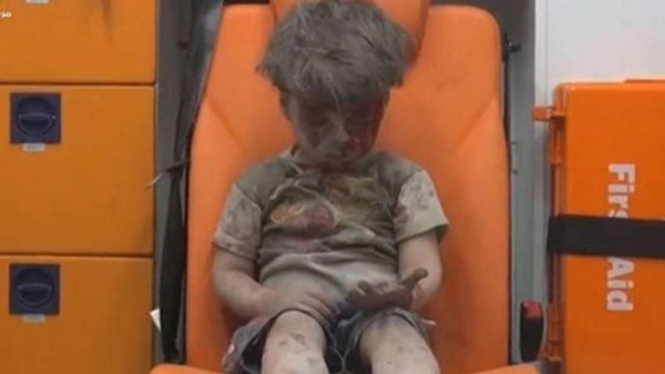 Foto seorang bocah Suriah dengan wajah penuh darah usai serangan di Aleppo, Rabu malam, 17 Agustus 2016.