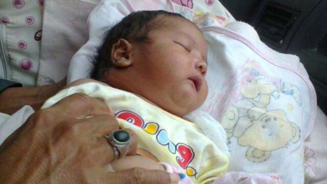 Syaidina Yusuf, bayi berusia 26 hari yang menderita penyakit Abses, penumpukan nanah di leher bagian belakang. Akibat penyakit ini, leher bayi ini nyaris terputus, Kamis (8/9/2016)