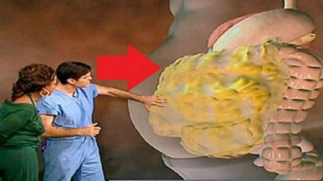 Cara Cepat Dan Efektif Untuk Membakar Lemak Perut Cara Cepat Dan Efektif Untuk Membakar Lemak Perut