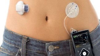 Pankreas Buatan untuk Pasien Diabetes Siap Dijual