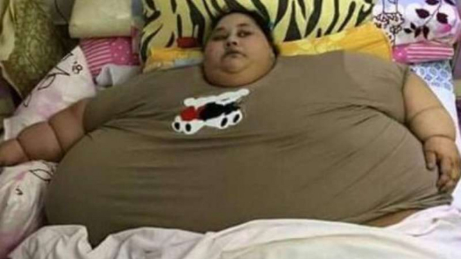 Iman Ahmad Abdulati, wanita dengan bobot 500 kg.