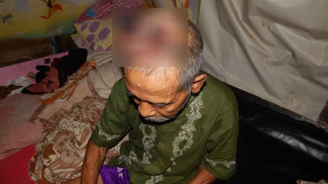 Mamad (68), penderita tumor ganas di kepala. Keterbatasan biaya membuat kakek ini terpaksa bertahan selama 9 tahun ini atas penyakitnya, Selasa (1/11/2016)