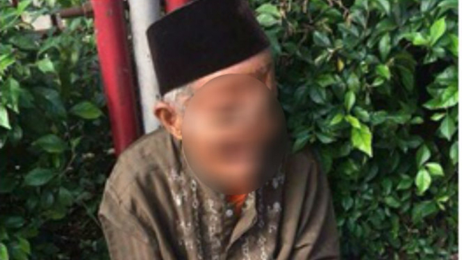 Kakek Abdurahman dengan luka bekas operasi kanker di wajahnya.