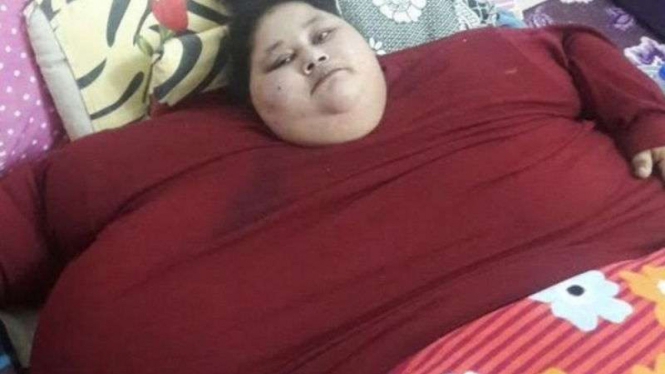 Eman Ahmed Abd El Aty, perempuan dengan bobot 500 kg.