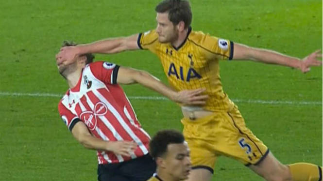 Bek Tottenham Hotspur, Jan Vertonghen, saat mencakar wajah Jay Rodriguez